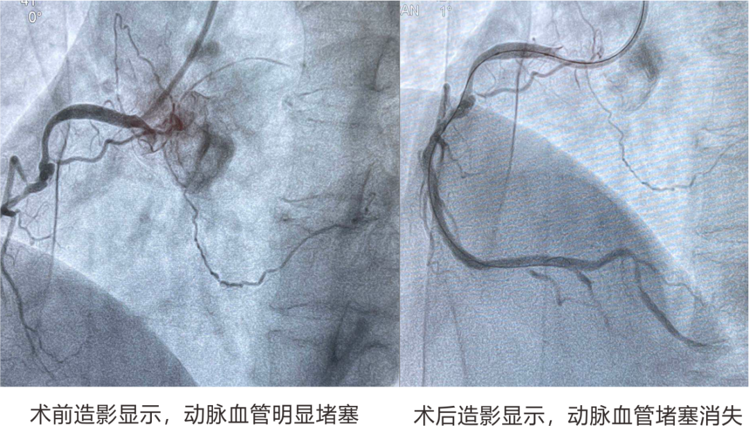 【保山安利醫(yī)院】冠心病——時(shí)刻警惕“人類(lèi)健康第一殺手”！